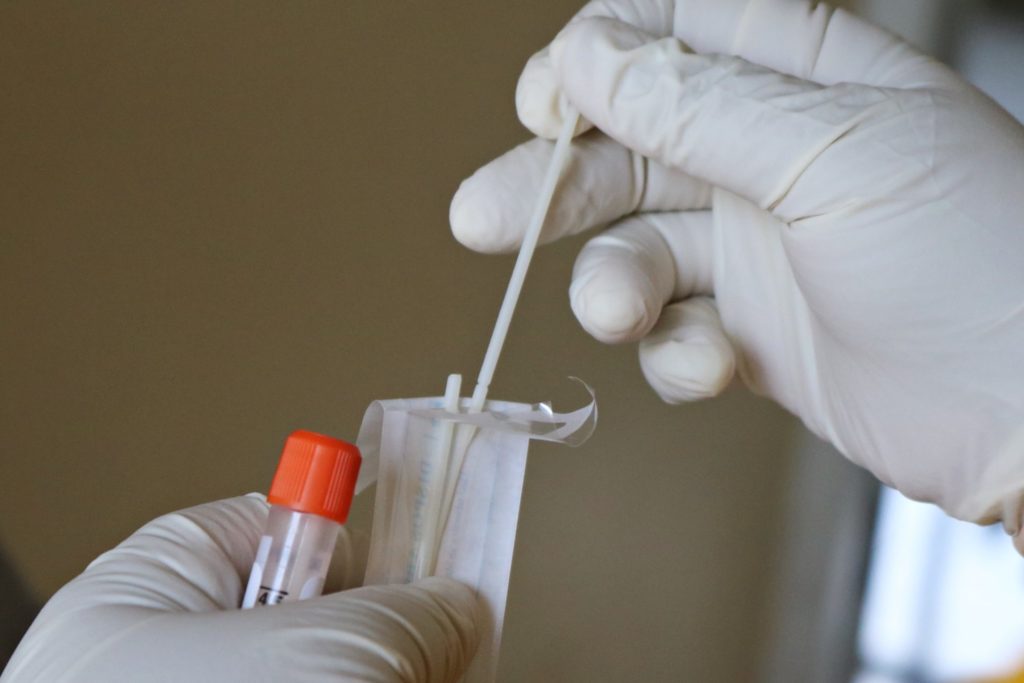 Testes de covid no Recife: preços variam em até 156%, diz Procon Testes de covid no Recife