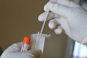 Testes de covid no Recife: preços variam em até 156%, diz Procon