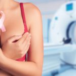 Câncer de mama e IA